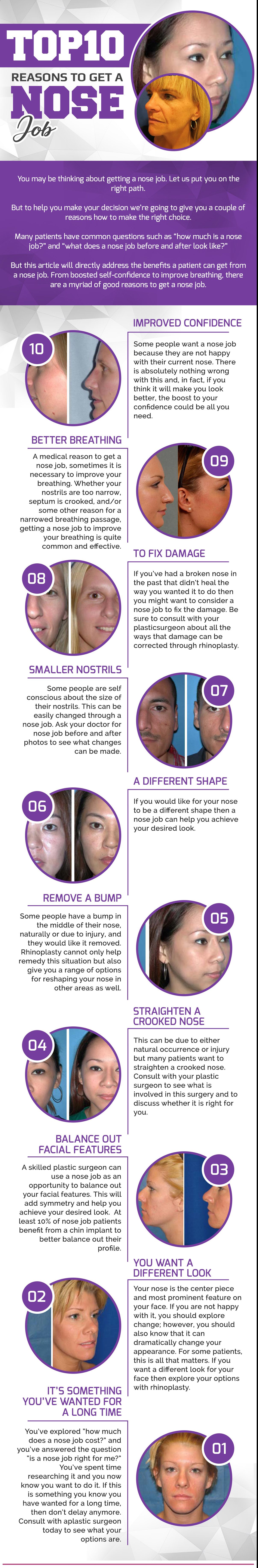 10 reasons to get a nose job